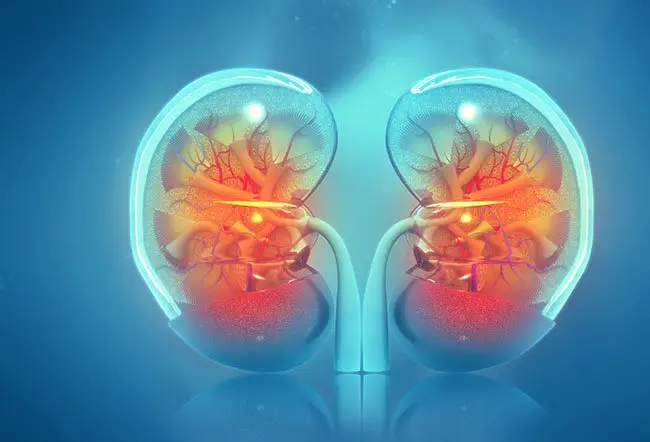 Acute Kidney Injury